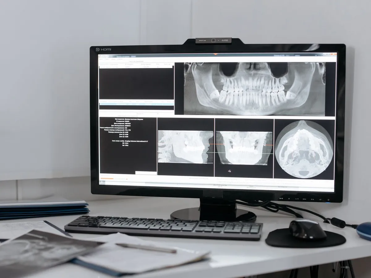 Un monitor de ordenador con imágenes dentales digitales