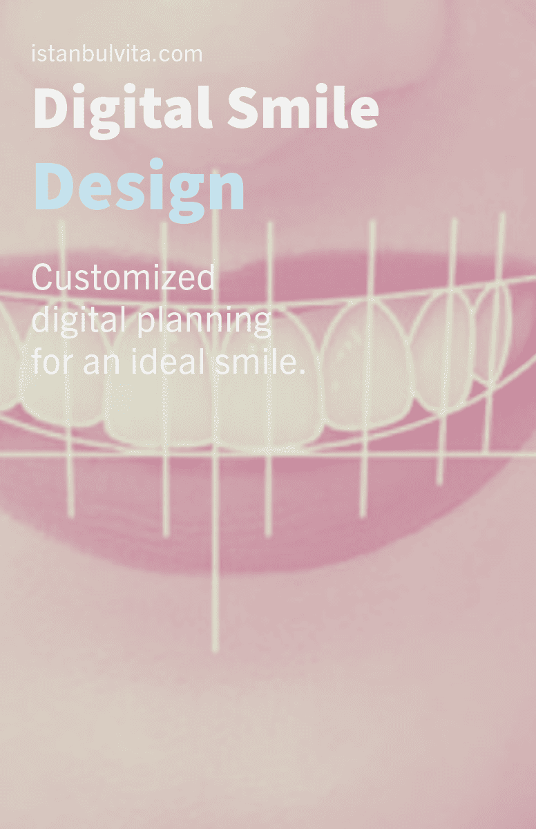 Vita Smile Before & After